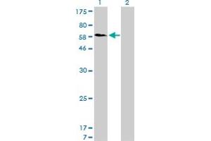 Western Blot analysis of SNX1 expression in transfected 293T cell line by SNX1 monoclonal antibody (M01), clone 6H1. (Sorting Nexin 1 抗体  (AA 166-275))