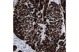 Immunohistochemical staining (Formalin-fixed paraffin-embedded sections) of human gallbladder shows strong cytoplasmic positivity in smooth muscle cells. (Transgelin 抗体  (AA 19-94))