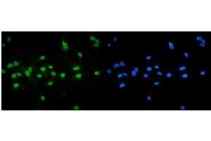 IF analysis of NR1H4 using anti-NR1H4 antibody (ABIN5518940).