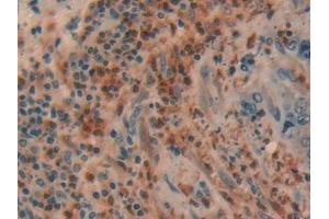 Immunohistochemistry (IHC) image for anti-Ubiquitin Carboxyl-terminal Esterase L1 (Ubiquitin Thiolesterase) (UCHL1) (AA 2-223) antibody (ABIN7436390)