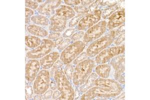 Immunohistochemistry of paraffin-embedded mouse kidney using NDUFS1 Rabbit pAb (ABIN7268819) at dilution of 1:50 (40x lens). (NDUFS1 抗体  (AA 80-290))