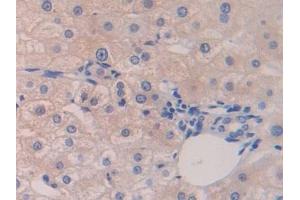 Immunohistochemistry (IHC) image for anti-Z-DNA Binding Protein 1 (ZBP1) (AA 10-167) antibody (ABIN7437785)