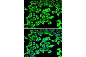 Immunofluorescence analysis of U2OS cells using RPLP2 antibody. (RPLP2 抗体)