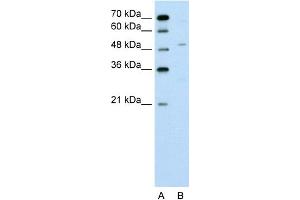 WB Suggested Anti-ZNF19 Antibody Titration:  0. (ZNF19 抗体  (N-Term))
