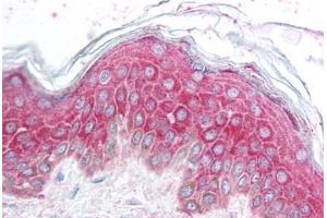 Human Skin (formalin-fixed, paraffin-embedded) stained with AVEN antibody ABIN213902 at 5 ug/ml followed by biotinylated goat anti-rabbit IgG secondary antibody ABIN481713, alkaline phosphatase-streptavidin and chromogen. (AVEN 抗体  (N-Term))