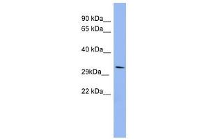 RRAD antibody used at 1 ug/ml to detect target protein. (RRAD 抗体  (Middle Region))