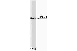 Western blot analysis of TRADD on a Jurkat cell lysate (Human T-cell leukemia, ATCC TIB-152).