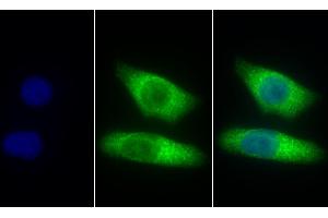 Detection of CTSZ in Human Hela cell using Polyclonal Antibody to Cathepsin Z (CTSZ) (Cathepsin Z 抗体  (AA 24-303))