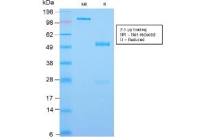 SDS-PAGE (SDS) image for anti-Caudal Type Homeobox 2 (CDX2) (AA 150-249) antibody (ABIN6939060)