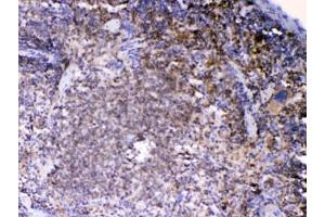 IHC testing of FFPE mouse spleen tissue with LYN antibody at 1ug/ml.
