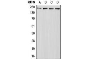 Western blot analysis of ABCA7 expression in HeLa (A), Raw264. (ABCA7 抗体  (C-Term))