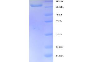 SDS-PAGE (SDS) image for Inositol-Trisphosphate 3-Kinase B (ITPKB) (AA 442-946) protein (His-SUMO Tag) (ABIN5709777)