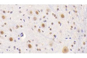 Detection of NCL in Mouse Cerebellum Tissue using Polyclonal Antibody to Nucleolin (NCL) (Nucleolin 抗体  (AA 353-568))