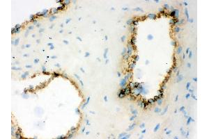 IHC analysis of VWF using anti-VWF antibody . (VWF 抗体  (AA 2535-2813))