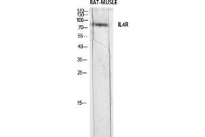 Western Blot (WB) analysis of Rat Muscle lysis using IL4R antibody. (IL4 Receptor 抗体)