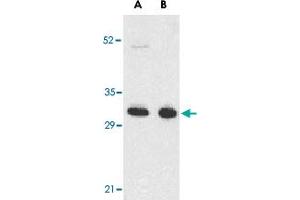 Western blot analysis of TNFRSF13B in K-562 (A) and U-937 (B) cell lysates with TNFRSF13B polyclonal antibody  at 5 ug/mL . (TACI 抗体  (N-Term))
