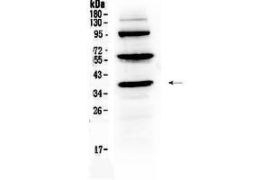 Western blot analysis of Thrombopoietin using anti-Thrombopoietin antibody . (Thrombopoietin 抗体  (AA 22-259))