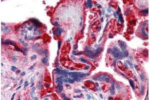 Human Placenta (formalin-fixed, paraffin-embedded) stained with C4B antibody ABIN364282 at 20 ug/ml followed by biotinylated secondary antibody, alkaline phosphatase-streptavidin and chromogen. (C4B 抗体)