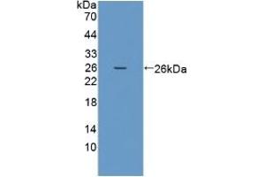 Detection of Recombinant PRSS1, Human using Polyclonal Antibody to Protease, Serine 1 (PRSS1) (PRSS1 抗体  (AA 51-228))