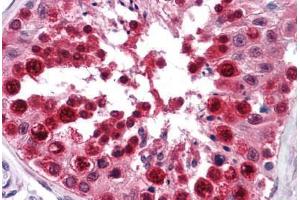 Human Testis: Formalin-Fixed, Paraffin-Embedded (FFPE) (PCBP2 抗体  (AA 1-363))
