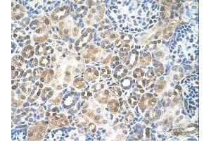RFC5 antibody was used for immunohistochemistry at a concentration of 4-8 ug/ml. (RFC5 抗体)