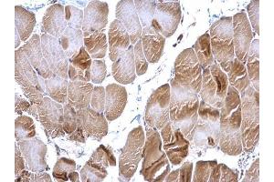 IHC-P Image RRM2 antibody [N1C1] detects RRM2 protein at cytoplasm on mouse muscle by immunohistochemical analysis. (RRM2 抗体  (Regulatory Subunit))