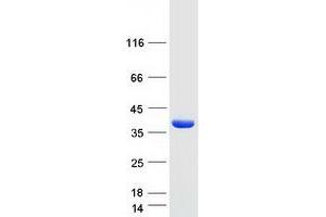 Validation with Western Blot