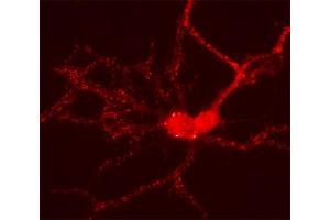 Indirect immunolabeling of PFA fixed cultured rat hippocampus neurons (dilution 1 : 500). (HOMER2 抗体  (AA 1-176))