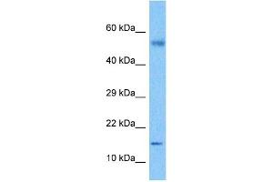 Host:  Rabbit  Target Name:  CSF2  Sample Tissue:  Lymph Node Tumor lysates  Antibody Dilution:  1ug/ml (GM-CSF 抗体  (C-Term))