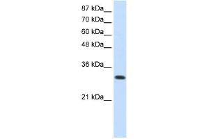 WB Suggested Anti-SCYE1 Antibody Titration:  0. (AIMP1 抗体  (N-Term))