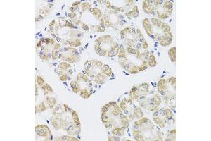 Immunohistochemistry of paraffin-embedded human stomach using PPP1CC antibody. (PPP1CC 抗体)