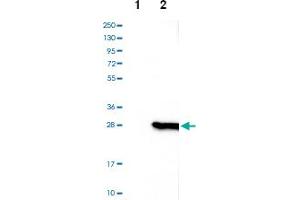 Western blot analysis of Lane 1: Negative control (vector only transfected HEK293T lysate), Lane 2: Over-expression lysate (Co-expressed with a C-terminal myc-DDK tag (~3. (CSDC2 抗体)