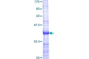 Apoptosis Inhibitor 5 Protein (API5) (AA 400-504) (GST tag)