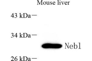 Nebulette antibody