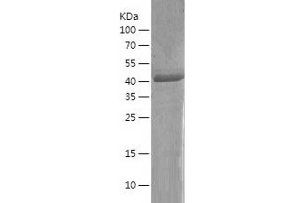 KLF17 Protein (AA 2-389) (His tag)