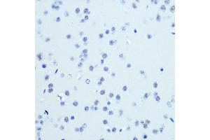 Immunohistochemistry (IHC) image for anti-Cyclin-Dependent Kinase 9 (CDK9) antibody (ABIN7266597)