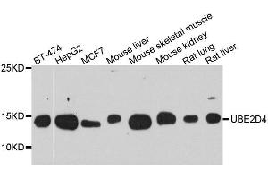 Western blot analysis of extracts of various cell lines, using UBE2D4 antibody. (UBE2D4 抗体  (AA 1-147))
