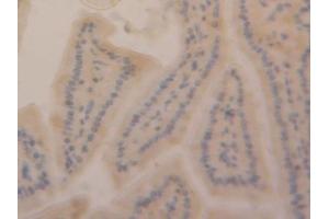 Detection of SIRT6 in Mouse Brain Tissue using Polyclonal Antibody to Sirtuin 6 (SIRT6) (SIRT6 抗体  (AA 1-334))