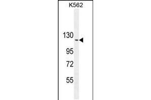 Western blot analysis in K562 cell line lysates (35ug/lane). (ARHGAP17 抗体  (N-Term))