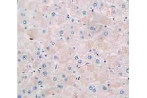 IHC-P analysis of Kidney tissue, with DAB staining. (CCL26 抗体  (AA 24-94))