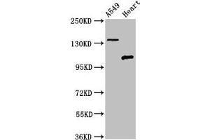 Western Blot Positive WB detected in: A549 whole cell lysate, Rat heart tissue All lanes: ADGRA2 antibody at 3 μg/mL Secondary Goat polyclonal to rabbit IgG at 1/50000 dilution Predicted band size: 143, 120, 20 kDa Observed band size: 143, 120 kDa (GPR124 抗体  (AA 1069-1338))