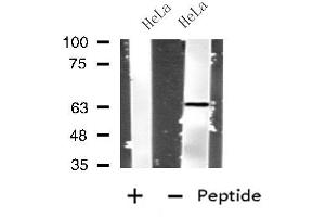 Western blot analysis of extracts from HeLa cells, using IL4I1 antibody. (IL4I1 抗体  (N-Term))