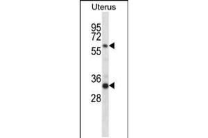 Western blot analysis in human normal Uterus tissue lysates (35ug/lane). (Fam172a 抗体  (AA 203-232))