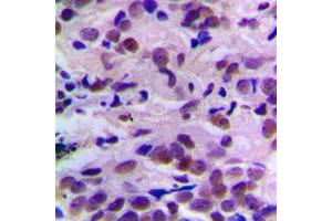 Immunohistochemistry (IHC) image for anti-Cyclin-Dependent Kinase 2 (CDK2) (pSer160) antibody (ABIN7295224)