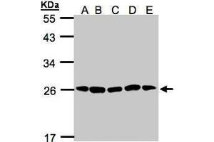 WB Image Sample(30μg of whole cell lysate) A: H1299 B: HeLa S3 , C: Hep G2 , D: MOLT4 , E: Raji , 12% SDS PAGE antibody diluted at 1:1000 (PSMA2 抗体  (Center))