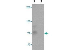 Western blot analysis of rat brain tissue with ZC3H12C polyclonal antibody  at 1 ug/mL in (Lane 1) the absence and (Lane 2) the presence of blocking peptide. (ZC3H12C 抗体  (N-Term))