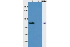 SDS-PAGE (SDS) image for anti-Tumor Necrosis Factor Receptor Superfamily, Member 25 (TNFRSF25) (AA 351-417) antibody (ABIN668421)