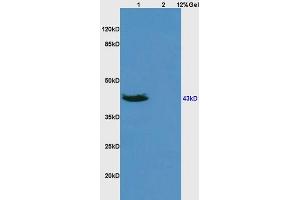 L1 human colon carcinoma lysates L2 rat brain lysates probed with Anti DR3/APO3/TWEAK Polyclonal Antibody, Unconjugated (ABIN668421) at 1:200 overnight at 4 °C. (DR3/LARD 抗体  (AA 351-417))