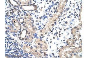 SNRPD1 antibody was used for immunohistochemistry at a concentration of 4-8 ug/ml to stain Epithelial cells of renal tubule (arrows) in Human Kidney. (SNRPD1 抗体  (N-Term))