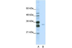 WB Suggested Anti-SFRS1 Antibody Titration:  0. (SRSF1 抗体  (C-Term))